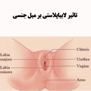تاثیر-لابیاپلاستی-بر-میل-جنسی