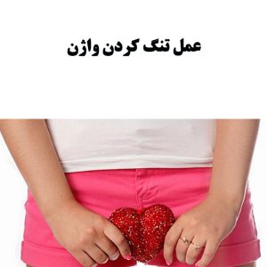 تنگ کردن واژن