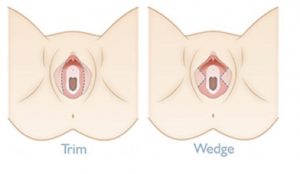 تکنیک های لابیاپلاستی