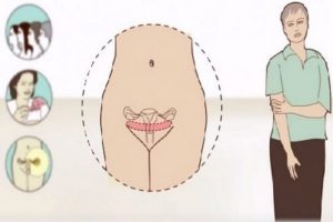 تغییرات واژن بعد از یائسگی